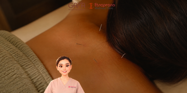 Takut Jarum? Medical Acupuncture di Etnaprana Wellness Clinic Bantu Redakan Nyeri dan Stres