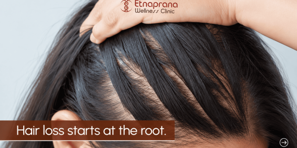 Cara Secretome Bikin Rambut Tebal, Reservasi Sekarang di Etnaprana Wellness Clinic