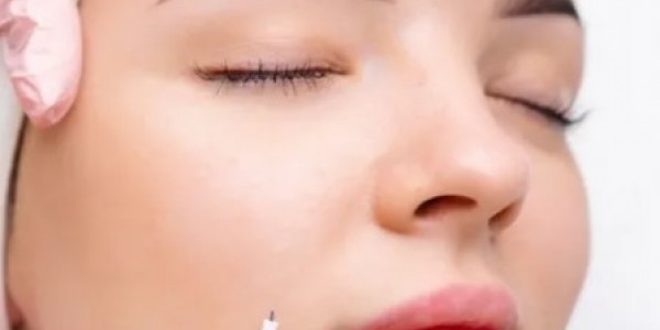 Mengenal Threadlift, Perawatan untuk Mengencangkan Kulit Tanpa Operasi