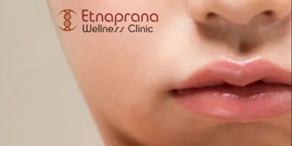 Transformasi Wajah Instan: Keunggulan Filler Hidung bagi Penampilan