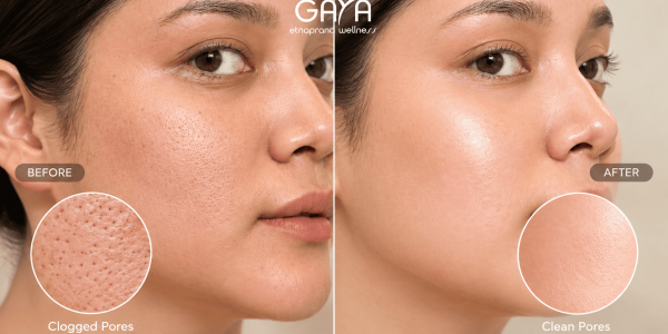 Rahasia Wajah Lebih Glowing? Coba Deep Cleansing Facial di Gaya Spa Wellness